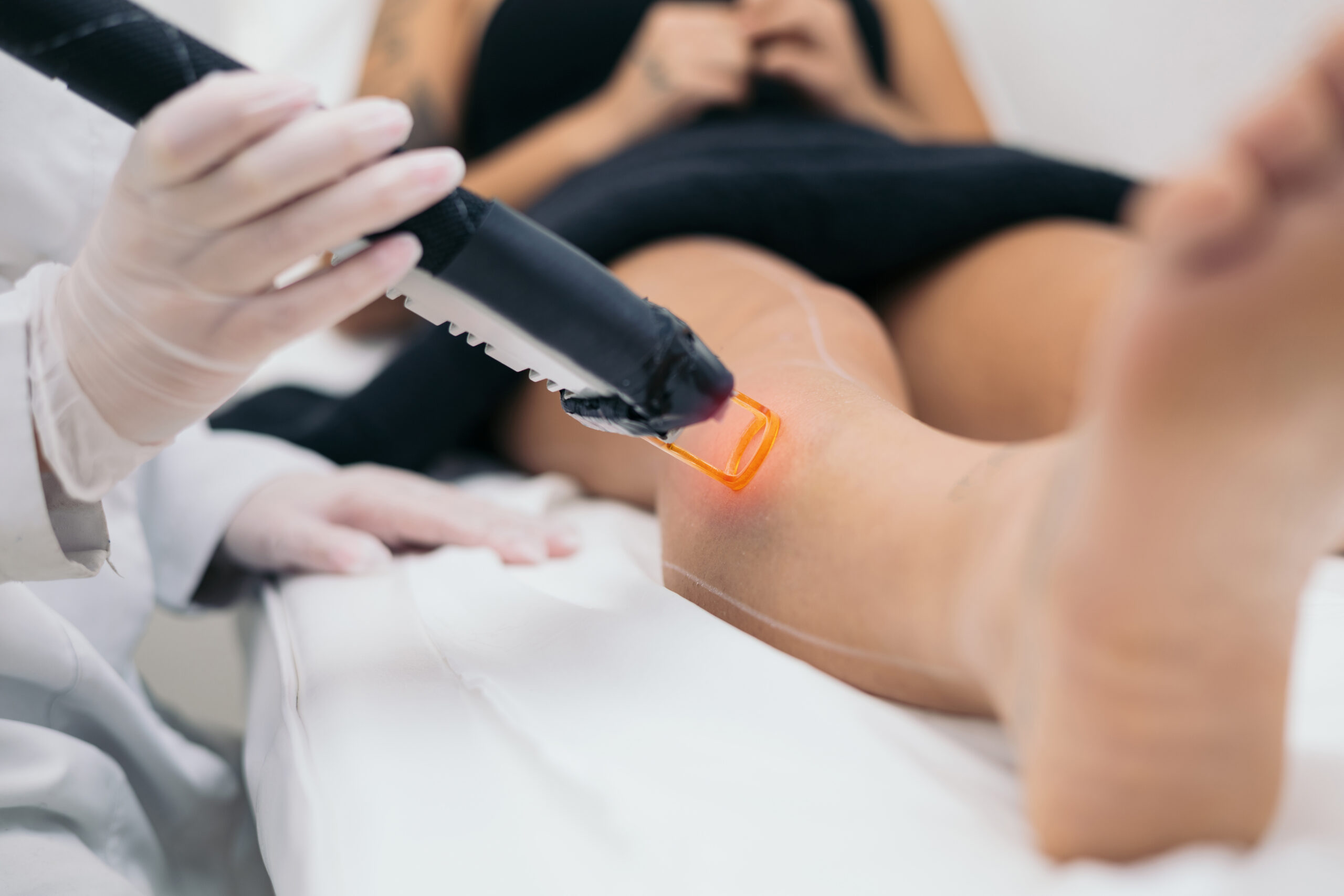 a woman during laser hair removal, laser hair removal on the legs in the beauty center. Concept of laser hair removal, concept of caring for oneself. Aesthetic clinic.